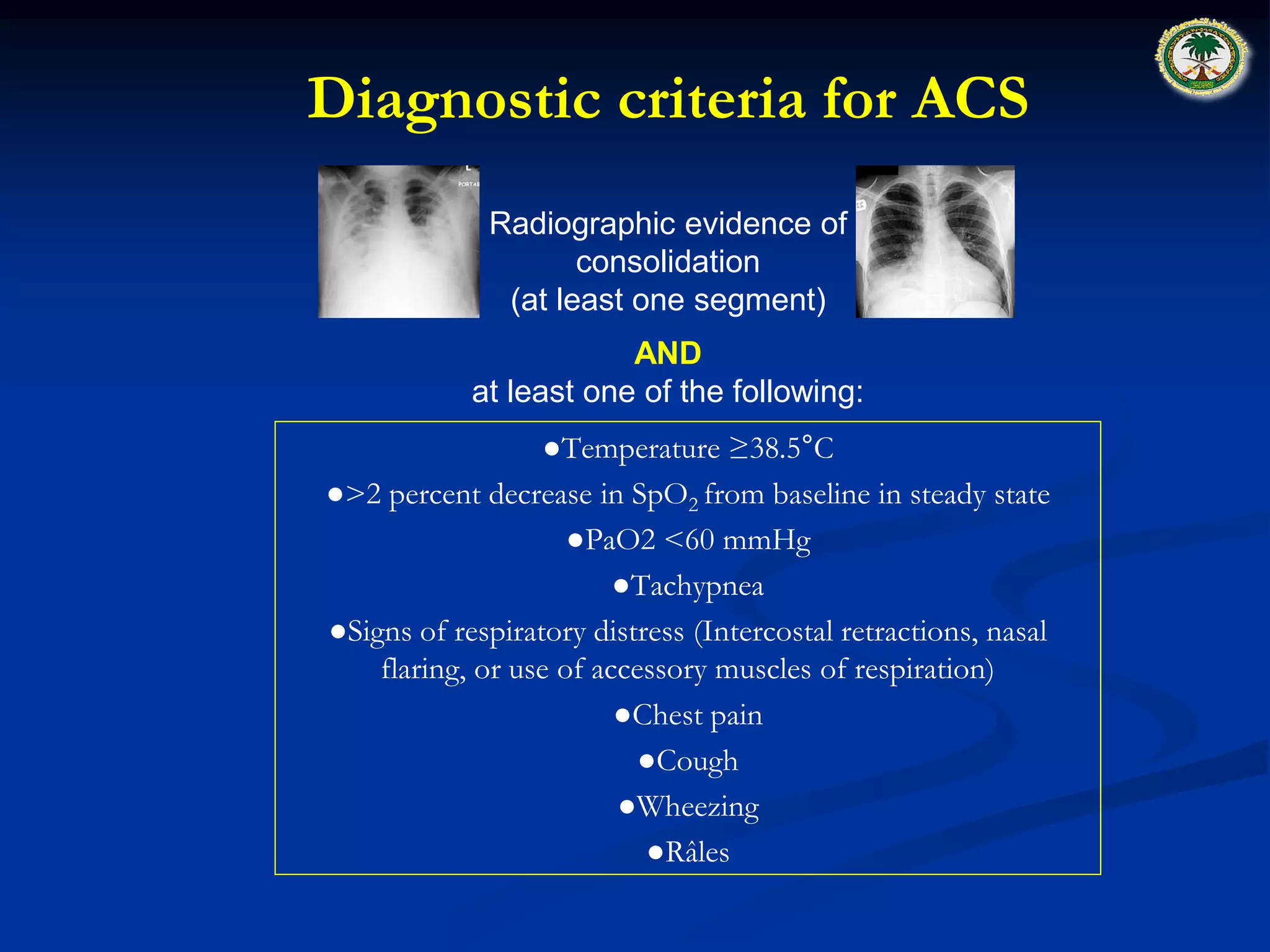 Pulmonary Complications of Sickle Cell Disease. pptx | PDF