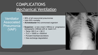COMPLICATIONS
Mechanical Ventilation
• 86% of all nosocomial pneumonias
• Upto 50% mortality
• Acinetobacter the commonest organism
• Suspicion : a new onset (<48hrs) or progressive
radiographic infiltrate with at least 2 of :
• Temp >38o C or < 36o C
• TLC > 10000 or <5000/ml
• Purulent tracheal secretions
• Gas exchange degradation
Ventilator
Associated
Pneumonia
(VAP)
 