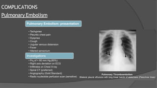 COMPLICATIONS
Pulmonary Embolism
Pulmonary Embolism: presentation
• Tachypnea
• Pleuritic chest pain
• Dyspnea
• Cough
• Jugular venous distension
• Fever
• Altered sensorium
Investigations
• Po2 of < 80 mm Hg (85%)
• Right axis deviation on ECG
• Infiltrates on Chest X-ray
• Spiral CT (preferred)
• Angiography (Gold Standard)
• Radio nucleotide perfusion scan (sensitive)
 