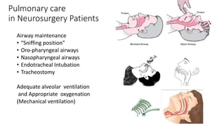 Pulmonary care
in Neurosurgery Patients
Airway maintenance
• “Sniffing position”
• Oro-pharyngeal airways
• Nasopharyngeal airways
• Endotracheal Intubation
• Tracheostomy
Adequate alveolar ventilation
and Appropriate oxygenation
(Mechanical ventilation)
 