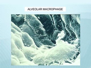 ALVEOLAR MACROPHAGE
 