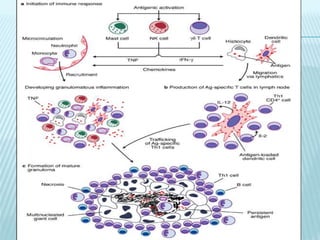 Pulmonary defense mechanisms