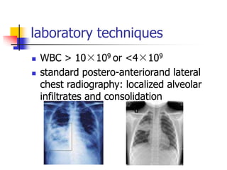 laboratory techniques
 WBC > 10×109 or <4×109
 standard postero-anteriorand lateral
chest radiography: localized alveolar
infiltrates and consolidation
 