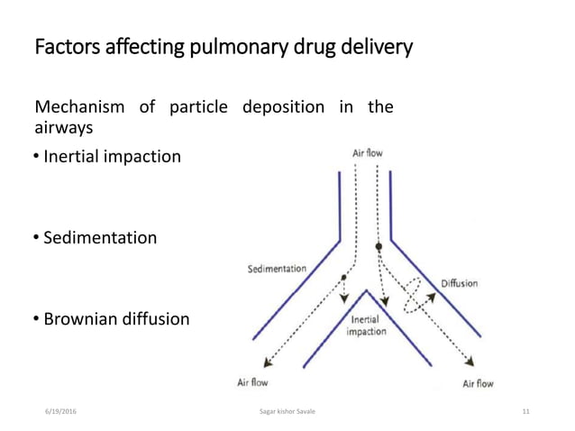 Pulmonary Drug Delivery System PDDS 