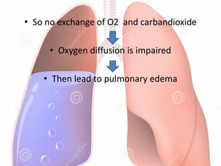 • So no exchange of O2 and carbandioxide
• Oxygen diffusion is impaired
• Then lead to pulmonary edema
 