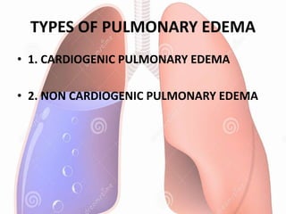 TYPES OF PULMONARY EDEMA
• 1. CARDIOGENIC PULMONARY EDEMA
• 2. NON CARDIOGENIC PULMONARY EDEMA
 