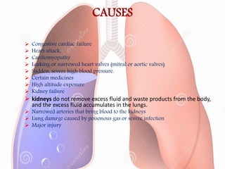CAUSES
 Congestive cardiac failure
 Heart attack,
 Cardiomyopathy
 Leaking or narrowed heart valves (mitral or aortic valves)
 Sudden, severe high blood pressure.
 Certain medicines
 High altitude exposure
 Kidney failure
 kidneys do not remove excess fluid and waste products from the body,
and the excess fluid accumulates in the lungs.
 Narrowed arteries that bring blood to the kidneys
 Lung damage caused by poisonous gas or severe infection
 Major injury
 