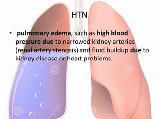 HTN
• pulmonary edema, such as high blood
pressure due to narrowed kidney arteries
(renal artery stenosis) and fluid buildup due to
kidney disease or heart problems.
 