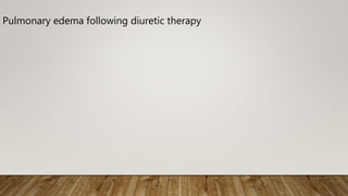 Pulmonary edema following diuretic therapy
 