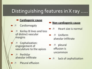 Distinguishing features inX ray …..
 Cardiogenic cause
  Cardiomegaly
  Kerley B lines and loss
of distinct vascular
margins
  Cephalization:
engorgement of
vasculature to the apices
  Perihilar
alveolar infiltrate
  Pleural effusion
 Non cardiogenic cause
  Heart size is normal
  Uniform
alveolar infiltrate
  pleural
effusion is
uncommon
  lack of cephalization
 