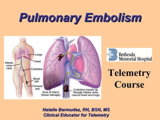 Pulmonary Embolism Natalie Bermudez, RN, BSN, MS Clinical Educator for Telemetry Telemetry Course 