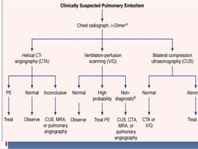 dimer clot test blood d Pulmonary Embolism