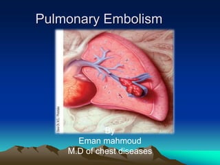 Pulmonary Embolism 
By 
Eman mahmoud 
M.D of chest diseases 
 