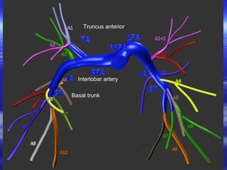 Truncus anterior 
Interlobar artery 
Basal trunk 
 
