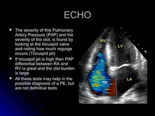 ECHOECHO
 The severity of this PulmonaryThe severity of this Pulmonary
Artery Pressure (PAP) and theArtery Pressure (PAP) and the
severity of the clot, is found byseverity of the clot, is found by
looking at the tricuspid valvelooking at the tricuspid valve
and noting how much regurgeand noting how much regurge
occurs (Tricuspid jet)occurs (Tricuspid jet)
 If tricuspid jet is high then PAPIf tricuspid jet is high then PAP
differential between RA anddifferential between RA and
RV is great and the clot burdenRV is great and the clot burden
is largeis large
 All these tests may help in theAll these tests may help in the
possible diagnosis of a PE, butpossible diagnosis of a PE, but
are not definitive testsare not definitive tests
 
