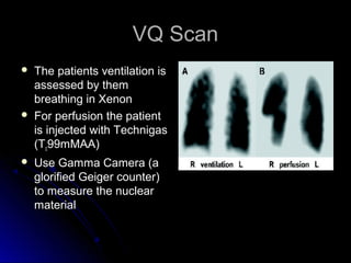VQ ScanVQ Scan
 The patients ventilation isThe patients ventilation is
assessed by themassessed by them
breathing in Xenonbreathing in Xenon
 For perfusion the patientFor perfusion the patient
is injected with Technigasis injected with Technigas
(T(Tcc99mMAA)99mMAA)
 Use Gamma Camera (aUse Gamma Camera (a
glorified Geiger counter)glorified Geiger counter)
to measure the nuclearto measure the nuclear
materialmaterial
 