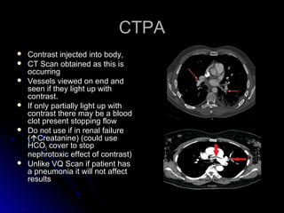 CTPACTPA
 Contrast injected into body,Contrast injected into body,
 CT Scan obtained as this isCT Scan obtained as this is
occurringoccurring
 Vessels viewed on end andVessels viewed on end and
seen if they light up withseen if they light up with
contrast.contrast.
 If only partially light up withIf only partially light up with
contrast there may be a bloodcontrast there may be a blood
clot present stopping flowclot present stopping flow
 Do not use if in renal failureDo not use if in renal failure
((Creatanine) (could useCreatanine) (could use
HCOHCO33 cover to stopcover to stop
nephrotoxic effect of contrast)nephrotoxic effect of contrast)
 Unlike VQ Scan if patient hasUnlike VQ Scan if patient has
a pneumonia it will not affecta pneumonia it will not affect
resultsresults
 