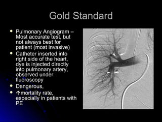 Gold StandardGold Standard
 Pulmonary Angiogram –Pulmonary Angiogram –
Most accurate test, butMost accurate test, but
not always best fornot always best for
patient (most invasive)patient (most invasive)
 Catheter inserted intoCatheter inserted into
right side of the heart,right side of the heart,
dye is injected directlydye is injected directly
into pulmonary artery,into pulmonary artery,
observed underobserved under
fluoroscopyfluoroscopy
 Dangerous,Dangerous,
 mortality rate,mortality rate,
especially in patients withespecially in patients with
PEPE
 