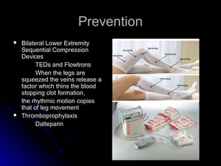 PreventionPrevention
 Bilateral Lower ExtremityBilateral Lower Extremity
Sequential CompressionSequential Compression
DevicesDevices
TEDs and FlowtronsTEDs and Flowtrons
When the legs areWhen the legs are
squeezed the veins release asqueezed the veins release a
factor which thins the bloodfactor which thins the blood
stopping clot formation,stopping clot formation,
the rhythmic motion copiesthe rhythmic motion copies
that of leg movementthat of leg movement
 ThromboprophylaxisThromboprophylaxis
DalteparinDalteparin
 
