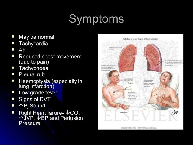 What Are The Symptoms Of A Blood Clot Unc Hemophilia And