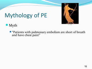 Mythology of PE
Myth
“Patients with pulmonary embolism are short of breath
and have chest pain!”
16
 
