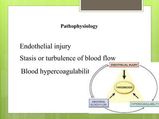 Pathophysiology
Endothelial injury
Stasis or turbulence of blood flow
Blood hypercoagulability
 