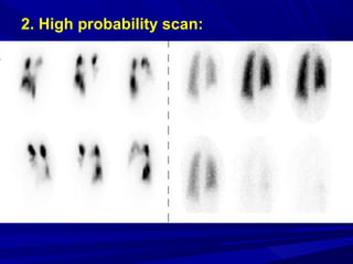 2. High probability scan:
 