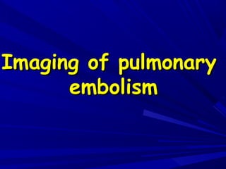 Imaging of pulmonaryImaging of pulmonary
embolismembolism
 