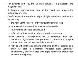 • For patients with PE, the CT scan serves as a prognostic and
diagnostic test.
• It shows a four-chamber view of the heart and images the
pulmonary arteries.
• Careful evaluation can detect signs of right ventricular dysfunction
by analyzing
– the right ventricular–to–left ventricular diameter ratio
– right ventricular–to–left ventricular volume ratio
– interventricular septal bowing, and
– reflux of contrast medium into the inferior vena cava.
Right ventricular enlargement on CT correlates with right
ventricular dysfunction and portends a complicated hospital
course often marked by clinical deterioration.
A right-to-left ventricular dimensional ratio of 0.9 or greater on a
chest CT scan is abnormal, indicates right ventricular
enlargement, and correlates with right ventricular dysfunction
on echocardiography.
 