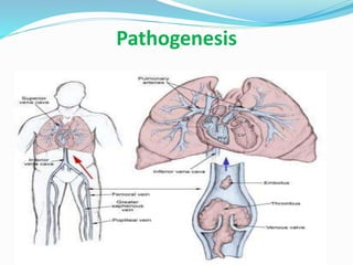 Pathogenesis
 