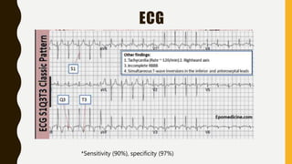ECG
*Sensitivity (90%), specificity (97%)
 