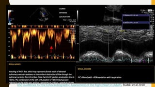 ASE Guidelines for the Echocardiographic Assessment of the Right Heart in Adults, Rudski et al 2010
 