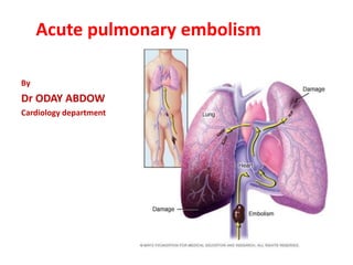 Acute pulmonary embolism
By
Dr ODAY ABDOW
Cardiology department
 
