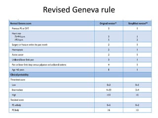 Revised Geneva rule
 