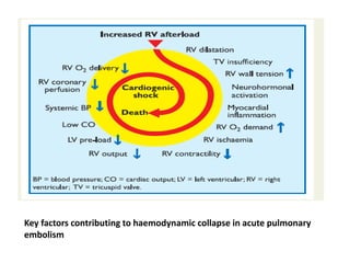 Key factors contributing to haemodynamic collapse in acute pulmonary
embolism
 