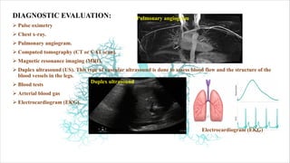 DIAGNOSTIC EVALUATION:
Ø Pulse oximetry
Ø Chest x-ray.
Ø Pulmonary angiogram.
Ø Computed tomography (CT or CAT scan).
Ø Magnetic resonance imaging (MRI).
Ø Duplex ultrasound (US). This type of vascular ultrasound is done to assess blood flow and the structure of the
blood vessels in the legs.
Ø Blood tests
Ø Arterial blood gas
Ø Electrocardiogram (EKG).
Pulmonary angiogram
Duplex ultrasound
Electrocardiogram (EKG)
 