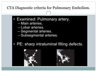 CTA Diagnostic criteria for Pulmonary Embolism.
 