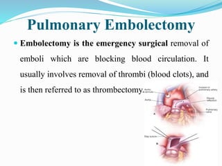 Pulmonary Embolectomy
 Embolectomy is the emergency surgical removal of
emboli which are blocking blood circulation. It
usually involves removal of thrombi (blood clots), and
is then referred to as thrombectomy.
 
