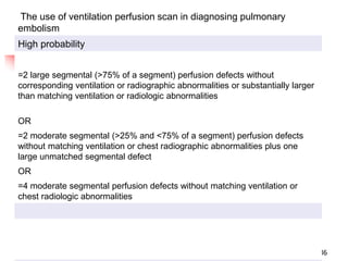 Pulmonary Embolism (1).ppt