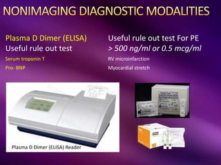 Plasma D Dimer (ELISA)
Useful rule out test
Useful rule out test For PE
> 500 ng/ml or 0.5 mcg/ml
Serum troponin T RV microinfarction
Pro- BNP Myocardial stretch
Plasma D Dimer (ELISA) Reader
 