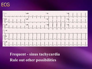 Frequent - sinus tachycardia
Rule out other possibilities
 