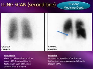 Ventilation
Gaseous radionuclides such as
xenon-133, krypton-81m, or
technetium-99m DTPA in an
aerosol form is inhaled
Nuclear
Medicine Deptt
Perfusion
intravenous injection of radioactive
technetium macro aggregated albumin
(Tc99m-MAA)
GAMMA
CAMERA
GAMMA
CAMERA
 