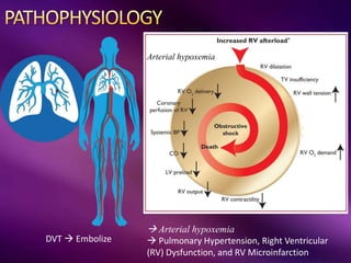  Arterial hypoxemia
 Pulmonary Hypertension, Right Ventricular
(RV) Dysfunction, and RV Microinfarction
DVT  Embolize
Arterial hypoxemia
 
