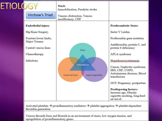 Virchow’s Triad
 