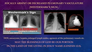 Watermark Sign Radiology Comprehensive Overview of Pulmonary Embolism Diagnosis and Imaging | PDF