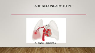 ARF SECONDARY TO PE
Dr. SINGH , RABINDRA
 
