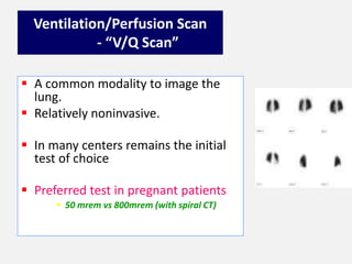 Ventilation/Perfusion Scan
- “V/Q Scan”
 A common modality to image the
lung.
 Relatively noninvasive.
 In many centers remains the initial
test of choice
 Preferred test in pregnant patients
 50 mrem vs 800mrem (with spiral CT)
 
