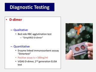 Diagnostic Testing
• D-dimer
– Qualitative
• Bed side RBC agglutination test
– “SimpliRED D-dimer”
– Quantitative
• Enzyme linked immunosorbent asssay
“Dimertest”
• Positive assay is > 500ng/ml
• VIDAS D-dimer, 2nd generation ELISA
test
 