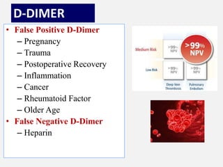 D-DIMER
• False Positive D-Dimer
– Pregnancy
– Trauma
– Postoperative Recovery
– Inflammation
– Cancer
– Rheumatoid Factor
– Older Age
• False Negative D-Dimer
– Heparin
 