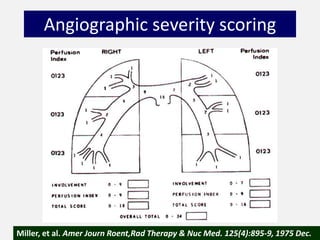 Angiographic severity scoring
Miller, et al. Amer Journ Roent,Rad Therapy & Nuc Med. 125(4):895-9, 1975 Dec.
 